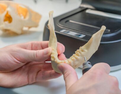 3D Printing in Modern Dental Care Explained