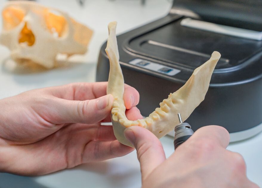 3D Printing in Modern Dental Care Explained