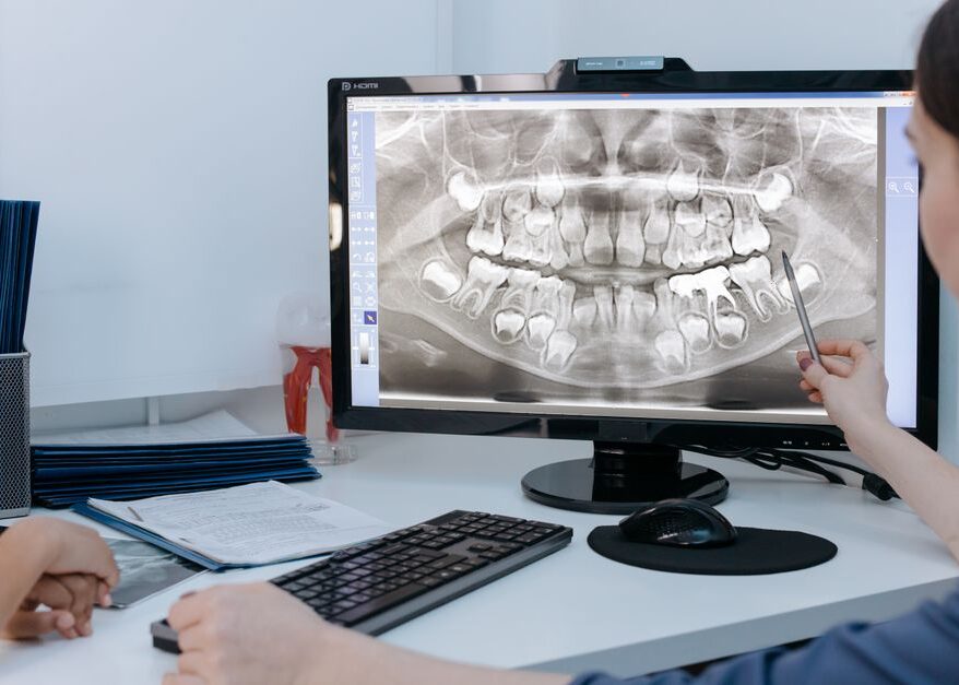 How Digital X-Rays Improve Dental Diagnosis