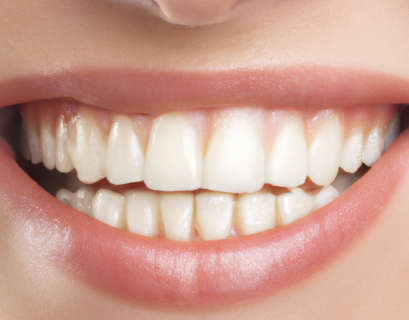 What Causes a Tooth to Need Restorative Work