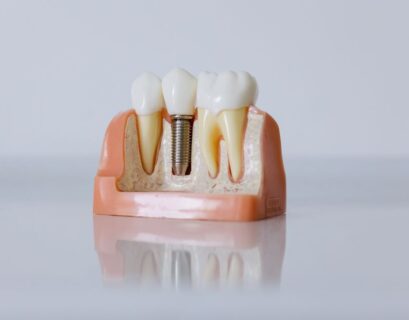 Dental Implant Maintenance for a Lifetime of Use